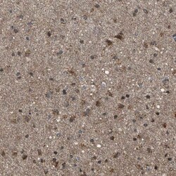 SGSM2 Antibody, Novus Biologicals 25 &mu;L | Buy Online | Novus Biologicals | Fisher Scientific